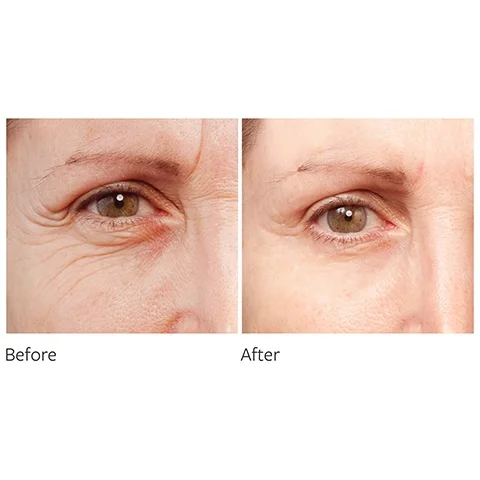 before and after
