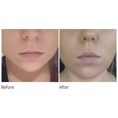 before and after