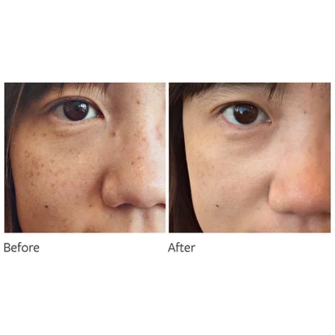 before and after
