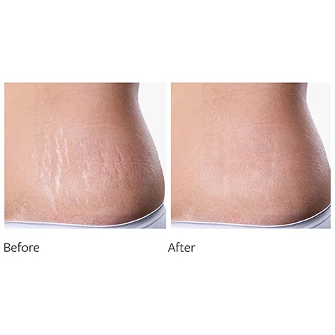 before and after