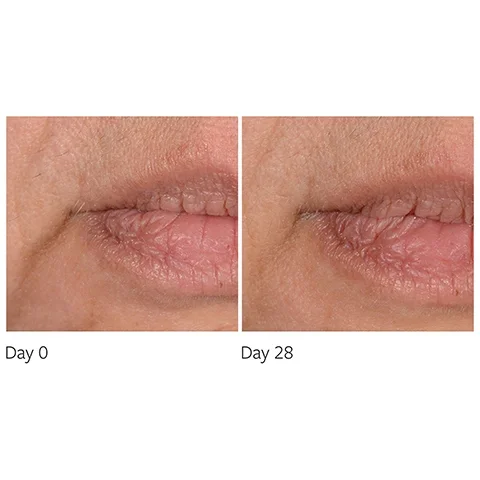 before and after