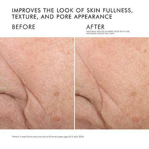 Image 1 - Side-by-side images of skin showing improvement in fullness and texture, with the left labeled BEFORE and the right labeled AFTER, including the text IMPROVES THE LOOK OF SKIN FULLNESS, TEXTURE, AND PORE APPEARANCE at the top, and INDIVIDUAL RESULTS (8 WEEKS TWICE DAILY USE). INDIVIDUAL RESULTS WILL VARY* at the bottom.
Image 2 - Image shows a clear glass bowl containing a creamy substance, with annotations listing key ingredients: 2% Pure Ceramides 1 & 3 with a description about moisture retention, 4% Natural Cholesterol noted for skin hydration, 2% Fatty Acids aiding skin elasticity, and an Essential Oil Blend of lavender, rosemary, and peppermint for a nourishing feeling.
Image 3 - A close-up image of a creamy white skincare product with descriptions outlining its benefits, stating it improves skin fullness, restores essential skin lipids, and promotes radiance and firmness, along with a product label that reads SkinCeuticals TRIPLE LIPID RESTORE 2:4:2 ANTI-AGING LIPID REPLENISHMENT TREATMENT 2% CERAMIDES | 4% CHOLESTEROL | 2% FATTY ACIDS.
Image 4 - A close-up of a person applying a cream to their cheek, with the text Restores + protects skins barrier displayed next to the cream.
Image 5 - A close-up of a thick, creamy emollient with visible text indicating the texture as Emollient cream and skin types listed as Normal, Dry, Combination, Sensitive.
Image 6 - Image shows a skincare morning regimen with four products: a brown bottle labeled C E Ferulic, a purple bottle labeled H. A. Intensifier Multi-Glycan, a white jar labeled Triple Lipid Restore 2:4:2, and a tube labeled Ultra Facial Defense Sunscreen SPF 50, with headings indicating steps for prevention and correction.
Image 7 - Image shows a skincare regimen laid out in four steps with corresponding product images; step 1 is Prevent with the product Resveratrol B E, step 2 is Correct with Retinol 0.3, step 3 is Correct with Triple Lipid Restore 2:4:2, and step 4 is Correct with A.G.E. Advanced Eye.