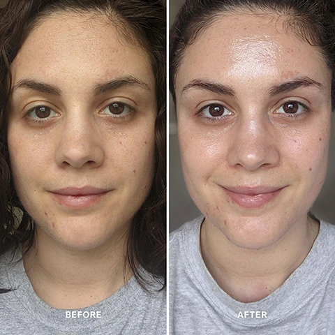 image 1, before and after. image 2, after 8 weeks, 88% saw an improvement in skin texture. 93% saw an improvement in skin elasticity. 88% saw an improvement in skin tone and luminosity. image 3, 93% saw an improvement in skin elasticity. 88% saw an improvement in skin tone and luminosity. 88% saw an improvement in skin texture