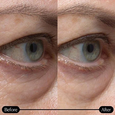 Image 1, before and after.