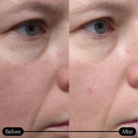 before and after