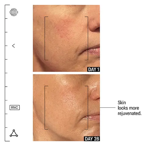 Image 1, skin looks more rejuvenated before and after model shots between 28 days. Image 2, PORE SAVIOR!
Blown away with how fast I saw results from this product, pretty much overnight. My biggest concern has been visible pores on my nose and this really clears everything out and makes their appearance very small/blurred, helping with reducing redness. Never considered any of my products