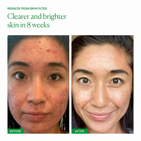 image 1 and 2, results from skin filter. clearer and brighter skin in 8 weeks. before and after. image 3, 92% agree that skin looks brighter. 90% agree that pigmentation looks reduced. consumer perception panel conducted by the nue co, april 2024, 25 respondents after two months use minimum. image 4, skinAx2 - clinically studied compound to brighten skin and reduce pigmentation. beta-carotene - natural form of vitamin a to stimulate fibroblasts and collagen. camu camu - natural source of antioxidant rich vitamin c to brighten skin and reduce dark marks. image 5, dullness, pigmentation and occasional breakouts. inner skin filter - for anyone who is looking to brighten their skin and reduce dark marks or pigmentation. clinically proven results in 60 days. one capsule daily with food. outer - skin filter serum. for anyone looking to improve skin texture, brighten skin, reduce dark marks and reduce fine lines. apply 2-3 pumps to clean, dry skin after cleansing in the PM. follow with barrier culture moisturiser. image 6, month 1 - fewer breakouts and any marks are disappearing faster, skin looks brighter. month 2 - skin looks brighter and noticeably clearer and more even tones. month 3 - reduction in dark marks or pigmentation, skin is clearer, brighter and fine lines are reduced. image 7, old packaging vs new packaging. as our new packaging phases in sustainably, you may receive either out old or new jar and box. inside the jar it's the same formula you know and love.