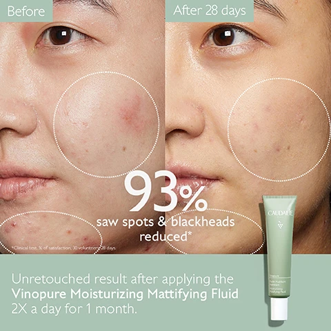 Image 1 - Side-by-side comparison of a persons face before and after using skincare product, showing reduced spots and blackheads, with visible text stating 93% saw spots & blackheads reduced, and the product name Vinopure Moisturizing Mattifying Fluid alongside usage instructions.
Image 2 - A woman with a radiant smile is applying a translucent cream to her cheek with one finger, while text beside her states Skin texture refined and 93% saw spots & blackheads reduced*.
Image 3 - A tube of green moisturizer labeled Vinopure Fluide Matifiant Hydratant Moisturizing Mattifying Fluid is surrounded by sprigs of rosemary, lavender, and mint, with a green grape and red berries nearby, and text indicating the product contains polyphenols, plant squalane, and silica powder.
Image 4 - An image of a tube of Vinopure Mattifying Fluid with recycling instructions, which read: How to recycle the Vinopure Mattifying Fluid, 1 Dispose of tube in recycling bin* 2 Recycle cap with TerraCycle, and a note stating that multi-material pumps are recyclable only in specific stores.
Image 5 - Image of a skincare routine featuring five products from Caudalie: a green tube labeled Purifying Gel Cleanser, a bottle labeled Purifying Toner, a green bottle labeled Blemish Control Salicylic Serum, a white tube labeled Moisturizing Mattifying Fluid, and a small tube labeled Salicylic Spot Solution, along with text indicating the steps: 1. Cleanse, 2. Purify, 3. Correct, 4. Mattify, and 5. Target.