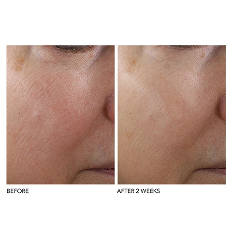 image 1 and 2, before and after 2 weeks.