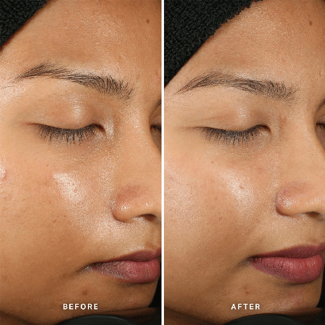 Two images transiting into each other in an endless loop. Image one: Text reads Before and After. Description - The before image shows skin before use. In the after image the skin appears smoother, clearer and skin is visibly luminous. Image two: Text reads Before and After. Description - The before image shows skin before usw. In the after image the skins redness has been reduced and appears smoother and calmer.