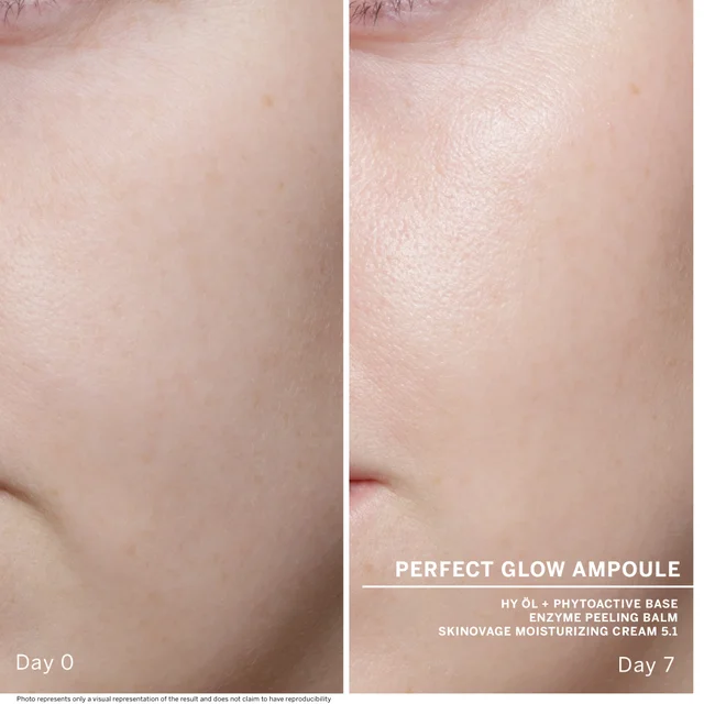 Text, Day 0, Perfect glow ampoule, Day 7, hy ol and phytoactive base,enzyme peeling balm, skinovage moisturizing cream 5.1, Photo represents only a visual representation of the result and does not claim to have reproducibility