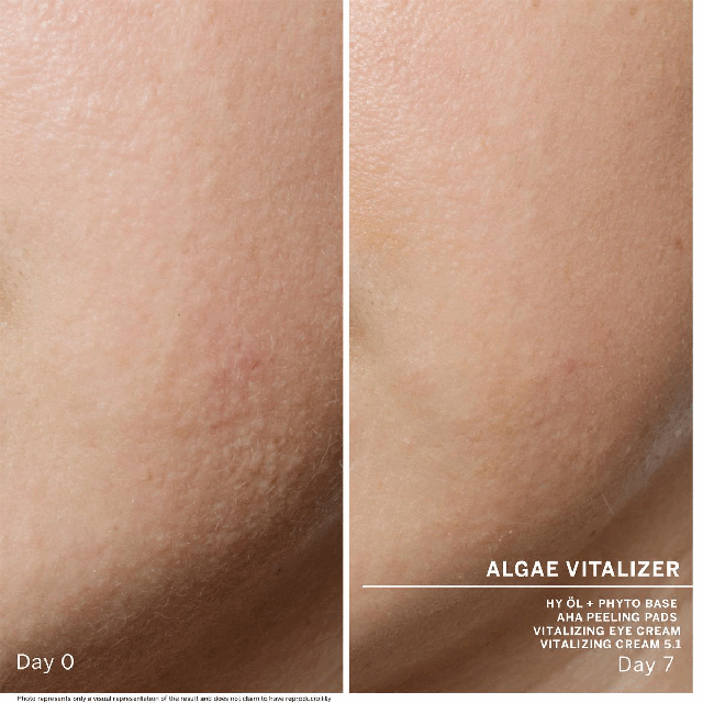 Two images transiting into each other in an endless loop.Image 1: ALGAE VITALIZER HY ÖL + PHYTO BASE AHA PEELING PADS VITALIZING EYE CREAM VITALIZING CREAM 5.1 Day 0- Description: skin before use Day 7- Description: skin appears visibly smoother and clearer. Photo represents only a visual representation of the result and does not claim to have reproducibility. Image 2: ALGAE VITALIZER HY ÖL + PHYTO COMBINATION ENZYME PEEL BALM BALANCING CREAM 5.2 Day 0- Description: skin before use Day 7- Description: skin appears visibly smoother and clearer. Photo represents only a visual representation of the result and does not claim to have reproducibility