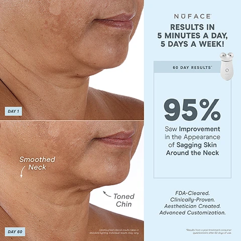 Image 1, day 1 vs day 60, smoothed neck and toned chin. unretouched clinical results taken in standard lighting - individual results may vary. results in 5 minutes a day, 5 days a week. 60 day results - 95% saw improvement in the appearance of sagging skin around the neck. FDA cleared, clinically proven, aesthetician created, advanced customization. results from a post treatment consumer questionnaire after 60 days of use. image 2, 1 device, 3 attachments, endless treatments. built in skin sensor - ensures consistent microcurrent intensity for all skin types. boost button - for +25% microcurrent power. smart device technology - perfect for advanced customization. facial trainer attachment - tones, lift and contours neck, cheek and forehead. additional attachments sold separately. energizing hum - gentle vibration when device is turned on. 3 intensity levels. unlock exclusive treatments - bluetooth enabled to pair with the NuFACE smart app. FDA cleared, clinically proven, aesthetician created. image 3, 1 device endless results. smooth the neck, contour the cheeks, lift the brow. image 4, before and after, lifted hooded eyelid and brow, lifted jaw. unretouched clinical results taken in standard lighting, individual results may vary. instant results in 5 minutes. immediate results - 90% saw a lifted appearance. FDA cleared, clinically proven, aesthetician created, advanced customisation. image 4, day 1 vs day 60 - reduced deep lines. unretouched clinical results take in standard lightening, individual results may vary. results in 5 minutes, 5 days a week. 60 day results, 93% saw reduction in the appearance of deep lines. FDA cleared, clinically proven, aesthetician created, advanced customisation. results from post treatment consumer questionnaire after 60 days of use. image 5, 1 device, endless customisable results. instant results that build with consistent use. contour - cheeks. lift - eyes and brows. tone - jowls and jawline. smooth - neck and forehead. lift - lips and smile lines. with effect lip and eye attachment. image 6, 1 device, endless customisable results. instant results that build with consistent use. contour - cheeks. lift - eyes and brows. tone - jowls and jawline. smooth - neck and forehead. lift - lips and smile lines. image 7, microcurrent 101. a low level electrical current that mimics and re-energises the body's natural current to tone, lift and contour down to the muscles. skincare is your nutrition. microcurrent is your fitness. trinity+ is fitness for your face. image 8, unlock app exclusive treatments to target different layers of skin and muscles. help reduce wrinkles and pump skin with skin tightening mode - epidermis. helps instantly lift and contour with instant lift mode - hypodermis. long term muscle sculpting with pro toning mode - muscle. after 15 minutes of use, after 14 days of use. unlocked with the nuface app. image 9, smart app. follow step by step tutorials, track progress. customise results with app exclusive treatments. set treatment reminders. image 10, comparison of three nuface devices. trinity+ advanced customisation. unlock app exclusive treatments - yes. boost with 25% microcurrent - yes. nuface smart app - yes. attachment options (eye and lip attachment and LEF red light attachment sold separately - yes. microcurrent treatment areas - jowls and jawline, neck, cheeks and forehead, around eyes and brows, around mouth and lips, smile lines. mini+ on the go lifting. unlock app exclusive treatments - yes. boost with 25% microcurrent - no. nuface smart app - yes. attachment options (eye and lip attachment and LED red light attachment sold separately - no. microcurrent treatment areas - jowls and jawline, neck, cheeks and forehead. fix, instant finisher.