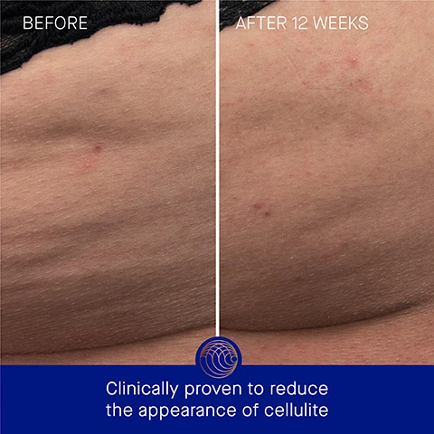 Image 3 - A side-by-side comparison of skin, showing a Before image on the left with visible texture and minor blemishes, and an After 12 Weeks image on the right, which appears smoother and clearer, with text at the bottom reading Clinically proven to reduce the appearance of cellulite.
Image 4 - Side-by-side comparison of skin showing stretch marks before and after treatment, with visible text stating BEFORE and AFTER 12 WEEKS, and a caption at the bottom stating Clinically proven to reduce the appearance of stretch marks.
Image 5 - A blue jar of Augustinus Bader body cream with a gold lid is shown on a soft background, featuring text that states there is a 74% reduction in the appearance of cellulite on the buttocks, a 64% reduction in cellulite on the thighs, and a 64% reduction in the appearance of stretch marks, with a note about a clinical trial.
Image 6 - A blue jar of Augustinus Bader The Body Cream with a copper lid is shown on a marble surface, with text stating 100% agree skin is intensely moisturized and hydrated, 92% agree the appearance of cellulite is reduced, and 90% agree appearance of stretch marks is reduced, followed by a note about a consumer perception study.
Image 7 - A blue jar of Augustinus Bader body cream with a gold lid is displayed against a gradient background, featuring text highlighting benefits such as TFC8, shea butter, bisabolol, and polysaccharide moisture complex.
Image 8 - Image shows a jar of Augustinus Bader The Body Cream being held in a hand alongside a spoon with a small amount of clear liquid on a textured surface, with text that reads: Step 1 Dispense desired amount into hands and massage into skin; Step 2 Reapply as needed, morning, night, and throughout the day; AB Insider Tip Layer under The Body Oil for an intensely moisturizing experience.
Image 9 - Image shows a side-by-side comparison of two body products: on the left, The Body Lotion with a blue tube display, and on the right, The Body Cream in a jar; both include details such as texture, key benefits, key concerns, and ideal skin types.
Image 10 - Image depicts a skincare routine with three steps listed: 1. Cleanse & Hydrate - THE BODY CLEANSER, 2. Soften & Smooth - THE BODY OIL, 3. Hydrate & Firm - THE BODY LOTION OR THE BODY CREAM.