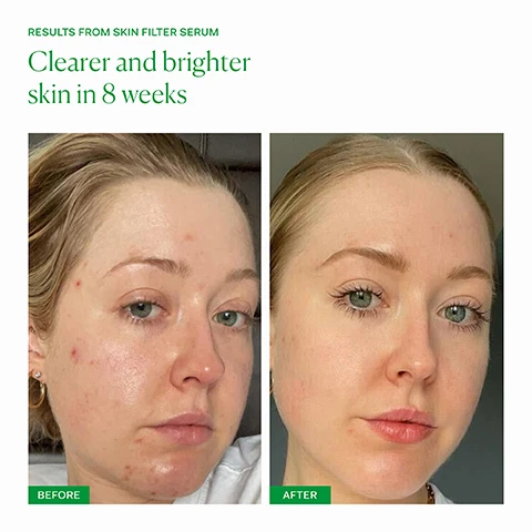 image 1, results from skin filter serum, clearer and brighter skin in 8 weeks. before and after. image 2, AHAs - glycolic, lactic, mandelic, malic, tartaric and citric acids unglue dead skin cells to smooth and brighten. bakuchiol and rambutan - plant based alternative retinols deliver results with no irritation. hyaluronic acid - holds up to 1000 times its weight in water to deeply hydrate. image 3, month 1 - reduction in breakouts and improvement in texture of skin. month 2 - skin appears more hydrated, smoother and brighter. month 3 - reduction in blackheads, breakouts and congestion in skin. skin is smoother, softer and brighter. image 4, 94% agree that skin looks brighter. 92% agree that blemishes are reduced. 96% agree that skin looks smoother. after 2 months of use. consumer perception panel 32 respondents. image 5, dullness, pigmentation and occasional breakouts. inner skin filter - for anyone who is looking to brighten their skin and reduce dark marks or pigmentation. clinically proven results in 60 days, one capsule daily with food. outer skin filter serum - for anyone looking to improve skin texture, brighten skin, reduce dark marks and reduce fine lines. apply 2-3 pumps to clean, dry skin after cleansing in the PM. follow with barrier culture moisturiser. image 6, old packaging vs new packaging. as our new packaging phases in sustainably, you may receive either out old or new jar and box. inside the jar it's the same formula you know and love.