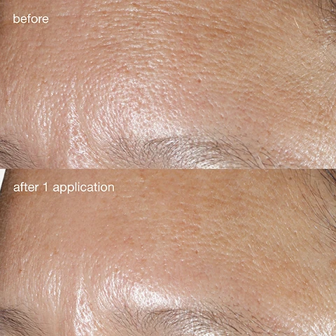 Image 1, before and after 1 application. image 2, before and after 1 week.