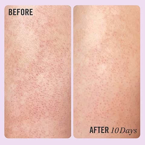 Image 1, before and after 10 days. Image 2, before and after 6 uses