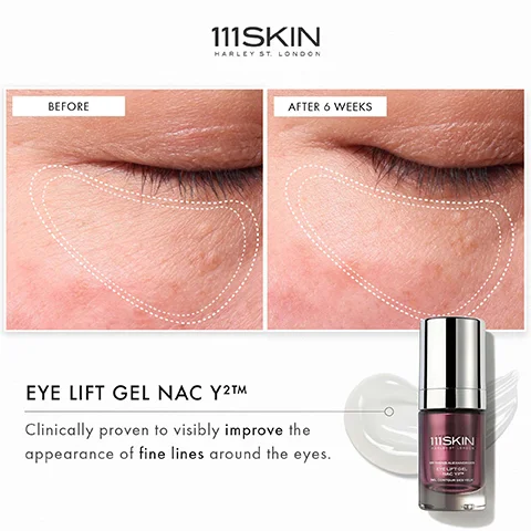 Image showing a comparison of eyelids labeled Before on the left and After 6 Weeks on the right, demonstrating the reduction of fine lines, with a product bottle of 111SKIN Eye Lift Gel NAC Y²™ placed on the bottom right; visible text includes EYE LIFT GEL NAC Y²™ Clinically proven to visibly improve the appearance of fine lines around the eyes.