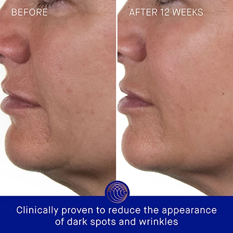 Image 3 - Side-by-side comparison of a persons profile before and after using a skincare product for 12 weeks, showing improvements in skin texture; visible text includes BEFORE, AFTER 12 WEEKS, and Clinically proven to reduce the appearance of dark spots and wrinkles.
Image 4 - A blue and gold bottle of skincare cream is shown next to an orange cap, with text stating Clinically Proven Results, Skin hydration is improved by 2.4x, Skin firmness and elasticity are improved by 36%, The appearance of forehead wrinkles visibly reduced by 37%, and *Based on a 4-week Clinical Trial of 30 participants.
Image 5 - A hand holds a blue and orange skincare bottle with text stating user proven results: 100% agree skin feels instantly hydrated and nourished, 100% agree complexion looks plump and replenished, 95% agree the appearance of fine lines/wrinkles is dramatically improved, with a footnote about a 12-week consumer perception study of 107 participants.
Image 6 - A blue and white skincare product bottle labeled Augustinus Bader with text highlighting ingredients and benefits, including TFC8®, Evening Primrose Oil, Argan Oil, and Hyaluronic Acid, along with their descriptions.
Image 7 - Two moisturizer products are displayed side by side: The Cream, shown in a blue and gold container, is described as a lightweight daily moisturizer ideal for combination to oily skin, while The Rich Cream, also in a blue and gold container, is characterized as a luxuriously rich daily moisturizer suitable for normal to dry skin.
Image 8 - A skincare routine chart featuring four steps: 1. Cleanse with THE CREAM CLEANSING GEL, 2. Correct & Hydrate with THE SERUM, 3. Nourish & Renew with THE CREAM, THE RICH CREAM OR THE ULTIMATE SOOTHING CREAM, and 4. Perfect & Revitalize with THE EYE CREAM.
Image 9 - Four skincare products from Augustinus Bader in blue and gold packaging, labeled with sizes 100 ml, 50 ml, 30 ml, and 15 ml, all stating THE RICH CREAM WITH TFC8.