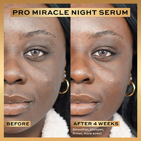 Image 1 - Image shows a side-by-side comparison of a womans face, with the left side labeled BEFORE showing skin with visible texture and uneven tone, and the right side labeled AFTER 4 WEEKS showing smoother and more even-toned skin, with visible text stating Smoother, plumper, firmer, more even! at the bottom.
Image 2 - A split image shows a young woman’s face in profile, with the left side labeled BEFORE displaying some blemishes and a matte appearance, and the right side labeled AFTER 4 WEEKS showing a smoother and shinier complexion; additional text reads Smoother, plumper, firmer, more even!
Image 3 - A hand holding a bottle of Revolution Pro Miracle Night Serum against a soft background, with text highlighting user agreement percentages on skin improvements, including plumper, smoother, and firmer skin.