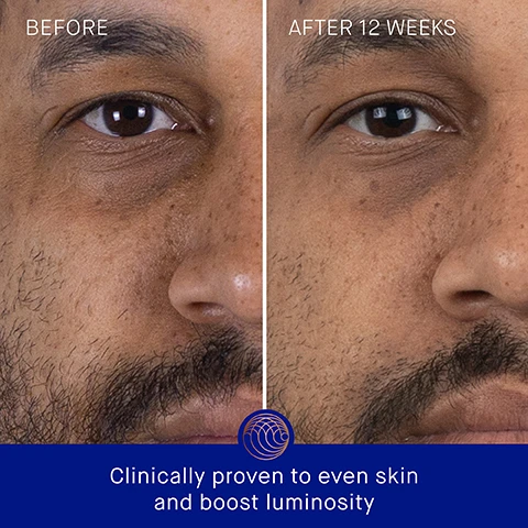 Image 3 - Image shows a side-by-side comparison of a mans face, with the left side labeled Before showing darker spots and uneven skin tone, and the right side labeled After 12 Weeks showing improved skin clarity and luminosity, accompanied by the text Clinically proven to even skin and boost luminosity at the bottom.
Image 4 - Side-by-side comparison of a mans face, showing before and after results of a treatment, with visible text stating BEFORE above the left image, AFTER 12 WEEKS above the right image, and Clinically proven to reduce the appearance of blemishes at the bottom.
Image 5 - An image of a serum bottle on a reflective surface, accompanied by text that states clinically proven results: the appearance of even skin tone is improved by over 3.6x, the appearance of wrinkles is reduced by 85%, and skin hydration is improved by over 3.9x, with a note about a clinical trial involving 30 participants aged 18 to 65.
Image 6 - Image shows a gold serum bottle on a light marble surface with text stating user proven results; 95% agree skin looks more luminous, 98% agree skin feels soft, supple and more elastic, 93% agree fine lines and wrinkles appear reduced, with a small footnote about a 12-week study.
Image 7 - An orange serum bottle labeled THE SERUM WITH TFC8® is centered against a blue background, with text descriptions about its key ingredients: TFC8® - A proprietary technology that creates the optimal environment for skin cellular renewal, EDELWEISS EXTRACT - Known to help lift, smooth and tighten sagging skin and wrinkles, POMEGRANATE SEED CONCENTRATE - Soothes and balances stressed skin, and VITAMIN C - Helps support the natural production of collagen for firmer, more resilient skin.
Image 8 - Image showing a three-step skincare routine with three panels: Step 1 features bottles with orange caps and text that says Dispense 2 pumps into hands, Step 2 shows a person using a product on their neck with text saying In upward sweeping motions, smooth over the face, neck and decolleté until fully absorbed, and Step 3 highlights a close-up of a persons face applying a product with text stating Follow by applying your Augustinus Bader moisturizer and eye cream.
Image 9 - Image shows two skincare products side by side: The Serum, an orange bottle with lightweight gel-serum texture, and The Retinol Serum, a blue bottle with lightweight cream-serum texture; both include sections for key benefits, key concerns, and ideal skin types.
Image 10 - Image shows a skincare routine layout with four numbered steps and corresponding product images including a cleansing gel, serum, nourishing cream, and eye cream, along with the text The Routine, 1. Cleanse THE CREAM CLEANSING GEL, 2. Correct & Hydrate THE SERUM, 3. Nourish & Renew THE CREAM, THE RICH CREAM OR THE ULTIMATE SOOTHING CREAM, and 4. Perfect & Revitalize THE EYE CREAM.
Image 11 - Three skincare product containers are displayed: a small gold bottle labeled Augustinus Bader, a medium gold bottle labeled THE SERUM WITH TFC8 and a larger blue bottle also labeled Augustinus Bader, with text reading 15 ml Refill, 30 ml Refill, and 30 ml.
