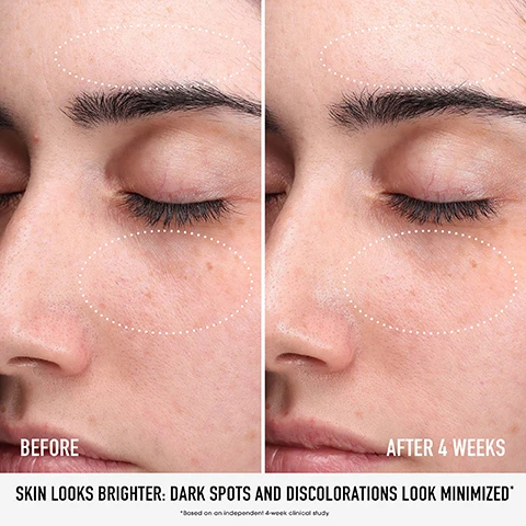 Image 1, before and after 4 weeks. skin looks brighter: dark spots and discolorations look minimised. based on an independent 4 week clinical study. image 2, routine to the rescue. start with clean, dry skin. step 1 = glow with skin rescue pure glow serum with 10% vitamin c complex and rainbow seaweed. AM step 2 = hydrate with skinlongevity phyto vitamin c brightening moisturiser mineral SPF 30. PM step 2 = strengthen with skin longevity long life herb night treatment. step 3 = restore with skin longevity long life herb eye treatment. image 3, rescue your skin. step 1 = squeeze serum into your palm. step 2 = pat into clean, dry skin. step 3 = wait 5 minutes. step 4 = finish with moisturiser, adding SPF in the morning. image 4, dual patented sensitive base = backed by 10 years of research. chebula = helps treat sun damage and skin aging. 5% niacinamide = improves cell metabolism and skin texture. image 5, dual patented sensitive base = backed by 10 years of research. 10% vitamin c = helps stimulate collagen production and treat hyperpigmentation. rainbow seaweed = helps to smooth fine lines. image 6, visibly brightens skin instantly. reduces the appearance of dark spots and discoloration in 4 weeks. image 7, clinically proven. significantly improve the condition of skin in 1 week. based on an independent clinical study. clinically proven. fights signs of aging in 7 days. instantly reduces fine lines and wrinkles by 41%. based on an independent clinical study. image 8, how to recycle. 1 = remove post consumer recycled plastic cap from bottle. 2 = remove glass dropper from cap, rinse and recycle. 3 = rinse glass and bottle and recycle.
