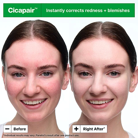 Image 1 - Image shows a side-by-side comparison of a womans face before and after using a skin treatment, with noticeable reduction in redness and blemishes; visible text includes Cicapair, Instantly corrects redness + blemishes, Before, Right After, and a note stating Individual results may vary.
Image 2 - Image of a jar of Dr. Jart+ Cicapair Soothing Color Correcting Treatment on a swirl background, with visible text highlighting its upgraded formula that neutralises redness, along with benefits such as barrier care, mineral sunscreen SPF 30, and easy to blend texture.
Image 3 - A woman with long dark hair is smiling and holding a green jar of Dr.Jart+ Cicapair Soothing Color Correcting Treatment, with a colorful pixelated background and the text 96% agreed it instantly corrects visible redness* next to her.
Image 4 - A green background features two jars of Dr. Jart+ Cicapair Color Correcting Treatment, labeled with the ingredients: Centella Asiatica Extracts reduces visible redness, Allantoin strengthens skin’s barrier, R-Protector soothes, and Zinc Oxide protects with mineral SPF.
Image 5 - A smiling woman with long brown hair is applying a green cream to her cheek while holding a jar labeled Dr.Jart+ Cicapair Soothing Color Correcting Treatment with a pastel pink and green geometric background, featuring text that reads Instantly conceals blemishes, Non-acnegenic, and Non-comedogenic.
Image 6 - Image shows a jar of Dr. Jart+ Cicapair Soothing Color Correcting Treatment with a light green cream inside, placed against a pink background, featuring visible text that reads +Dermatologist tested +Suitable for Rosacea and Sensitive Skin and includes the National Rosacea Society logo with the word ACCEPTED.