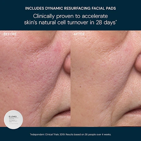 Image 6 - A before and after comparison image shows a close-up of a persons skin, with the left side labeled BEFORE displaying prominent pores and redness, and the right side labeled AFTER showing smoother skin with reduced pores and redness, alongside a white jar of Elemis Dynamic Resurfacing Facial Pads, with the following text: INCLUDES DYNAMIC RESURFACING FACIAL PADS Clinically proven to accelerate skins natural cell turnover in 28 days* ELEMIS DYNAMIC RESURFACING FACIAL PADS Skin refining pads Disques affinant le grain de peau 14 x 2.1 in (5.5 cm) DIA Pads *Independent Clinical Trials 2019. Results based on 36 people over 4 weeks. Image 7 - Two Elemis skincare products, a white jar of facial pads and a black tube of mens marine cream, are displayed on a blue background with text that reads: DYNAMIC RESURFACING FACIAL PADS Clinically proven to accelerate skin’s natural cell turnover in 28 days* PRO-COLLAGEN MARINE CREAM FOR MEN Clinically proven to reduce the appearance of fine lines and wrinkles in 14 days** ELEMIS DYNAMIC RESURFACING FACIAL PADS Skin refining pads Disques affinant le grain de peau 14 x 2.1 in (5.5 cm) DIA Pads ELEMIS PRO-COLLAGEN MARINE CREAM FOR MEN Anti-wrinkle moisturiser Crème hydratante anti-rides MEN 15 ml e 0.5 US fl.oz *Independent Clinical Trials 2019. Results based on 36 people over 4 weeks. **Independent Clinical Trial 2021. Results based on 36 people over 4 weeks. Image 8 - An Elemis 5-step skincare routine is displayed on a dark blue background, showing Step 1: Cleanser, a white tube of Elemis Dynamic Resurfacing Facial Wash 30ml 1.0 US fl.oz; Step 2: Exfoliator, a white round container of Elemis Dynamic Resurfacing Facial Pads Skin refining pads Disques affinant le grain de peau 14 x 2.1 in (5.5 cm) DIA Pads; Step 3: Shave Gel, a dark can of Elemis Ice-Cool Foaming Shave Gel Close-shave foaming gel Gel moussant – Rasage de près MEN 100 ml e 3.3 US fl.oz; Step 4: Eye Cream, a light blue tube of Elemis Pro-Collagen Vitality Eye Cream Replenishing eye cream Crème revitalisante pour les yeux; and Step 5: Moisturiser, a black tube of Elemis Pro-Collagen Marine Cream for Men Anti-wrinkle moisturiser Crème hydratante anti-rides MEN 15ml e 0.5 US fl.oz.