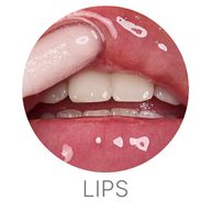 ICONIC London Lips