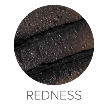 Omorovicza Redness
